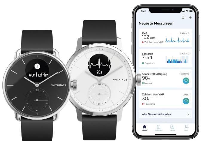 Die Health-Mate-App dient der grafischen Auswertung der mit der Scanwatch erfassten Vitaldaten. Sie reicht diese auf Wunsch an die Health-App von Apple weiter – einige Nutzer mögen jedoch die Withings-Anwendung sogar bevorzugen.